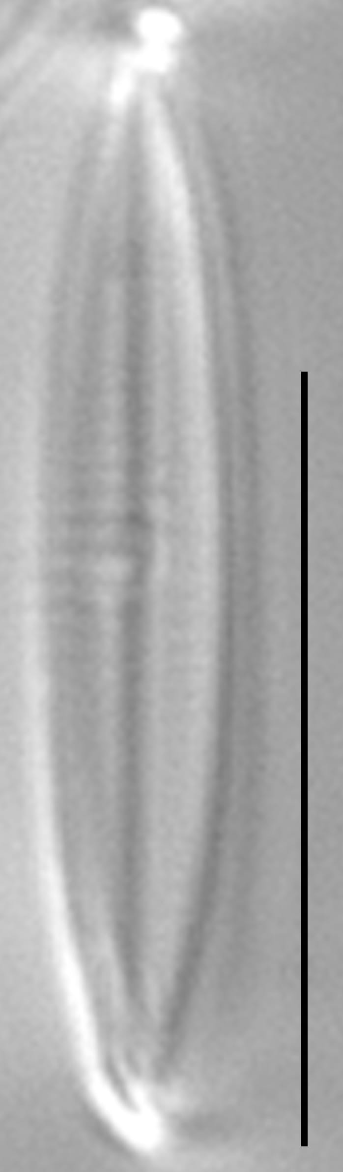 Proschkinia vergostriata LM1