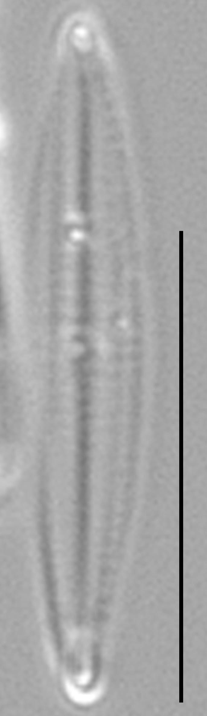 Proschkinia vergostriata LM2