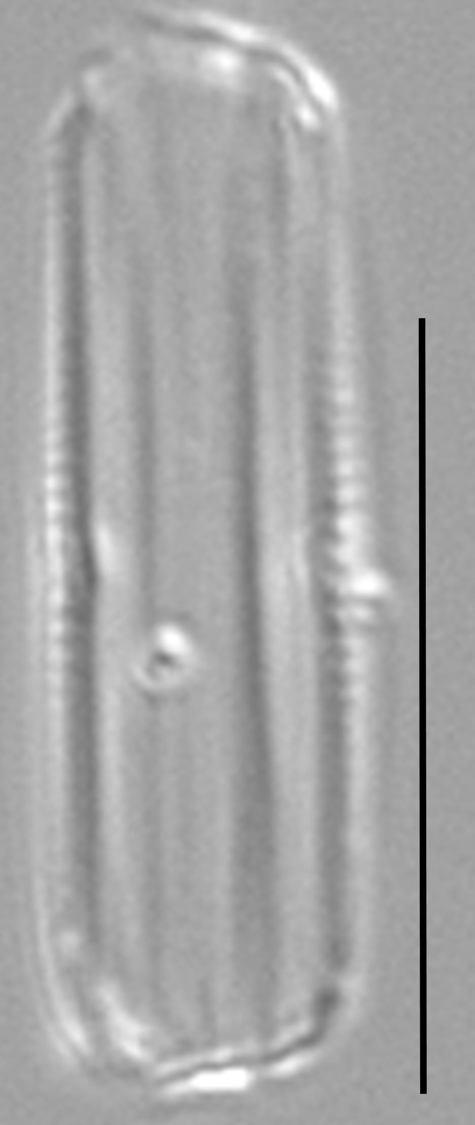 Proschkinia vergostriata LM7