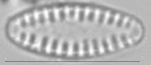 Pseudostaurosira brevistriata LM5