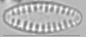 Pseudostaurosira brevistriata LM5