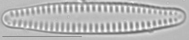 Pseudostaurosira brevistriata LM4