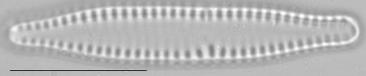 Pseudostaurosira brevistriata LM3