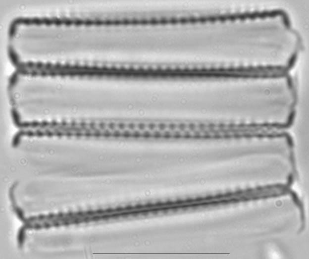 Pseudostaurosira brevistriata LM1