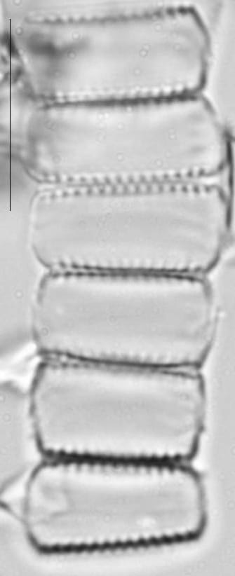Pseudostaurosira neoelliptica LM2