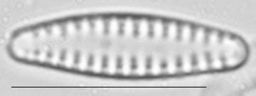 Pseudostaurosira neoelliptica LM1