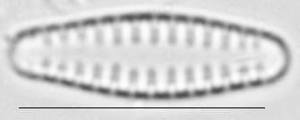 Pseudostaurosira neoelliptica LM5