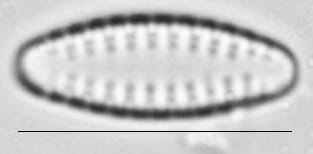 Pseudostaurosira neoelliptica LM3
