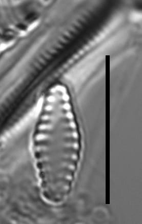 Pseudostaurosiropsis geocollegarum1 ILL L1433