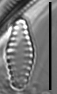 Pseudostaurosiropsis geocollegarum1 ILL L1433