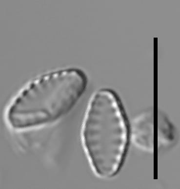 Pseudostaurosiropsis geocollegarum2 ILL L1433