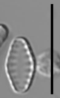 Pseudostaurosiropsis geocollegarum2 ILL L1433