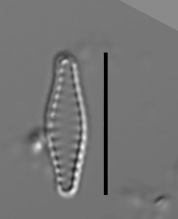 Pseudostaurosiropsis geocollegarum6 ILL L1433