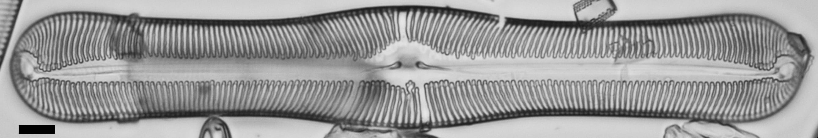 Pulchella canadensis LM1