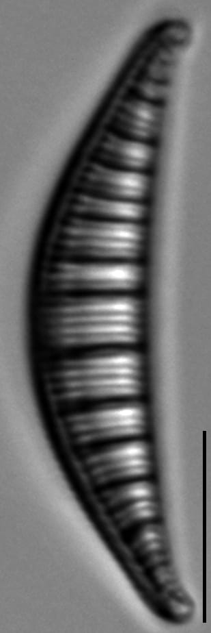 Rhopalodia gibberula LM12