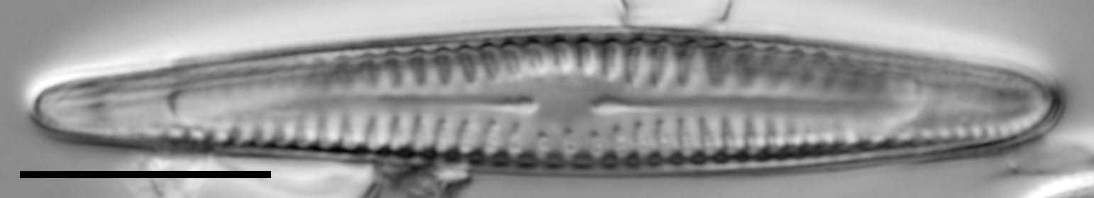 Rhoicosphenia californica LM2