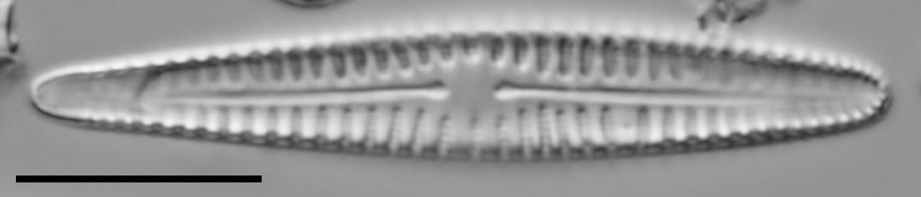 Rhoicosphenia californica LM4