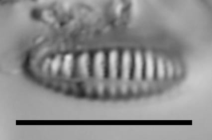 Rhoicosphenia californica LM7