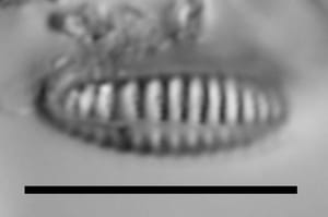 Rhoicosphenia californica LM7