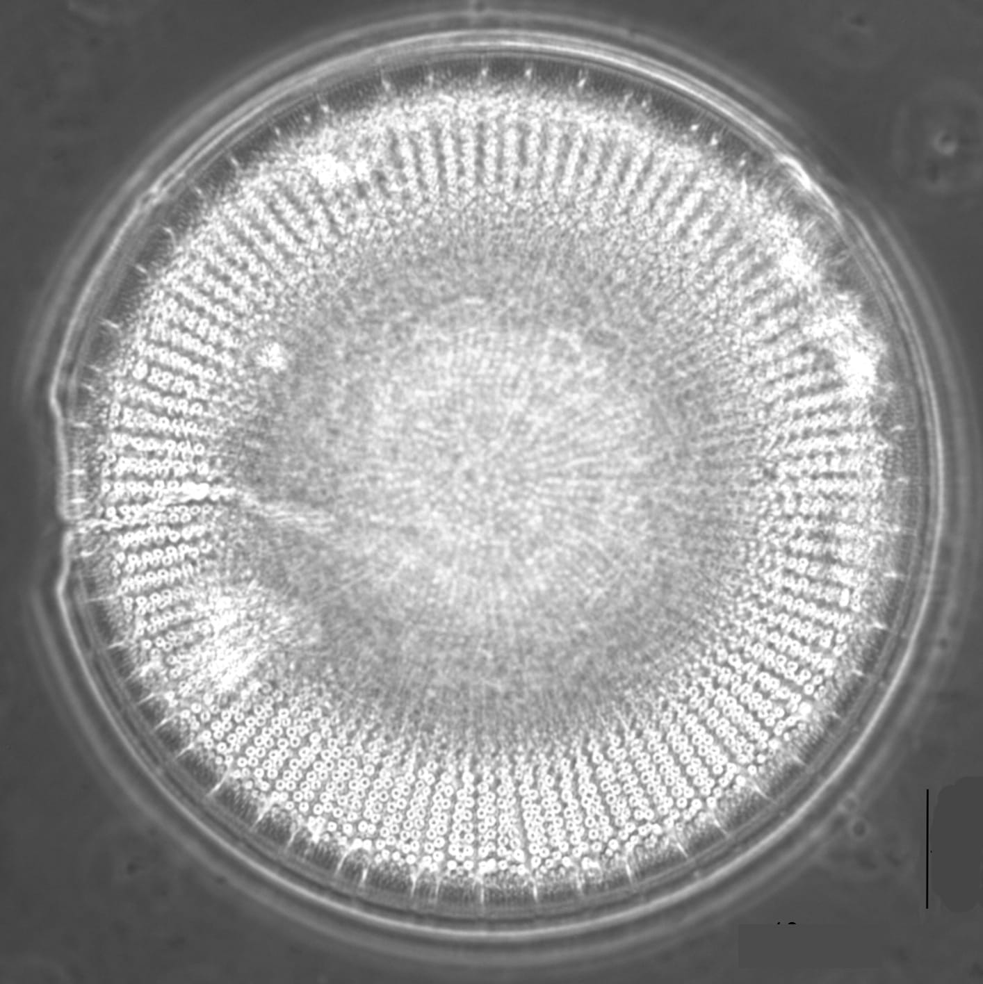 Reimer Col  L8 38 Spines Ins Margin