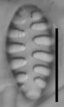 Staurosirella martyi LM1