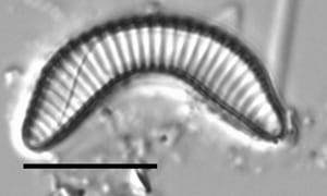 Semiorbis eliasiae LM5