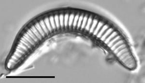 Semiorbis eliasiae LM4