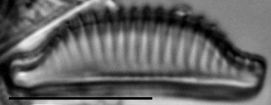 Semiorbis catillifera LM5