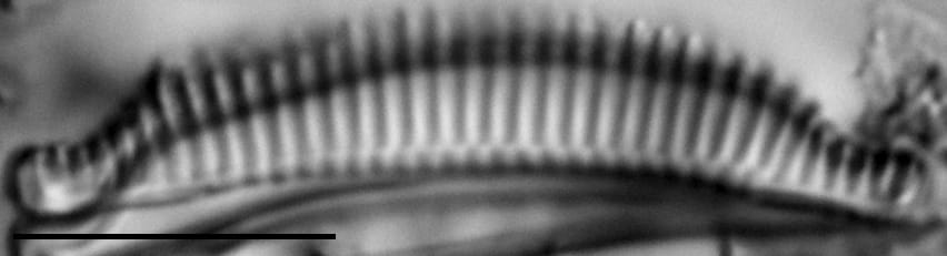 Semiorbis catillifera LM2