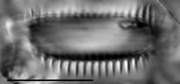 Semiorbis catillifera LM4