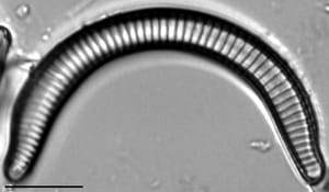 Semiorbis rotundus LM6