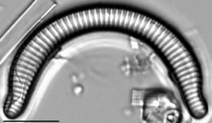 Semiorbis rotundus LM3