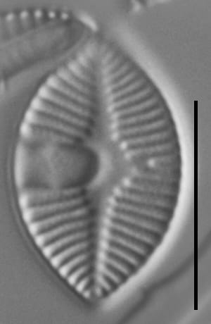 Skabitschewskia oestrupii LM5