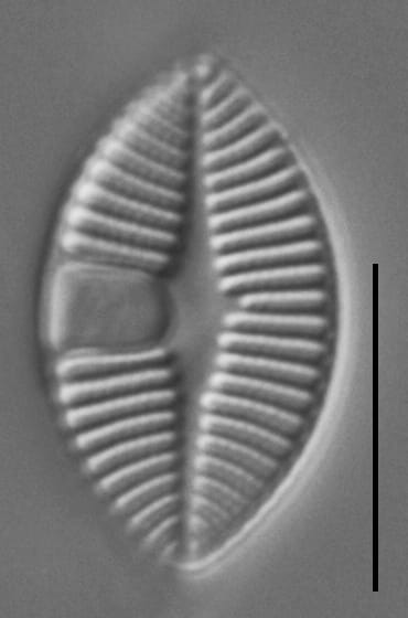 Skabitschewskia oestrupii LM2