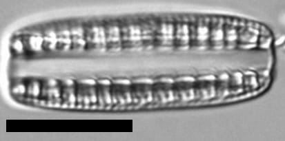 Denticula kuetzingii LM7