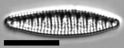 Denticula kuetzingii LM5