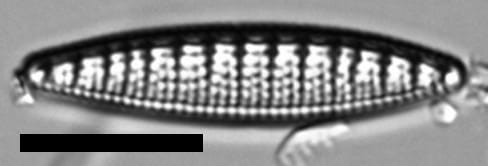 Denticula kuetzingii LM6