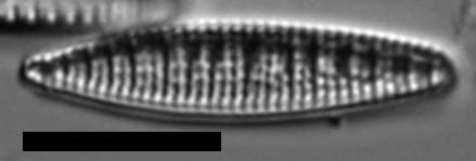 Denticula kuetzingii LM2