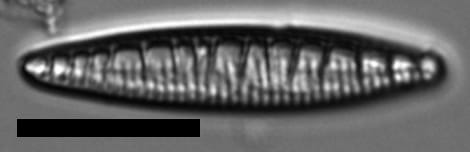 Denticula kuetzingii LM4