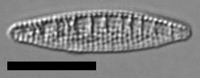 Denticula kuetzingii LM3