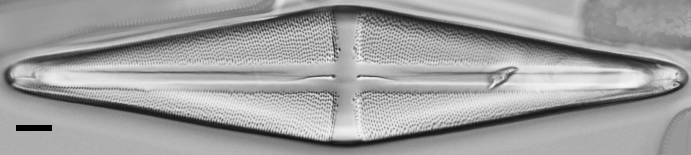 Stauroneis terry LM1