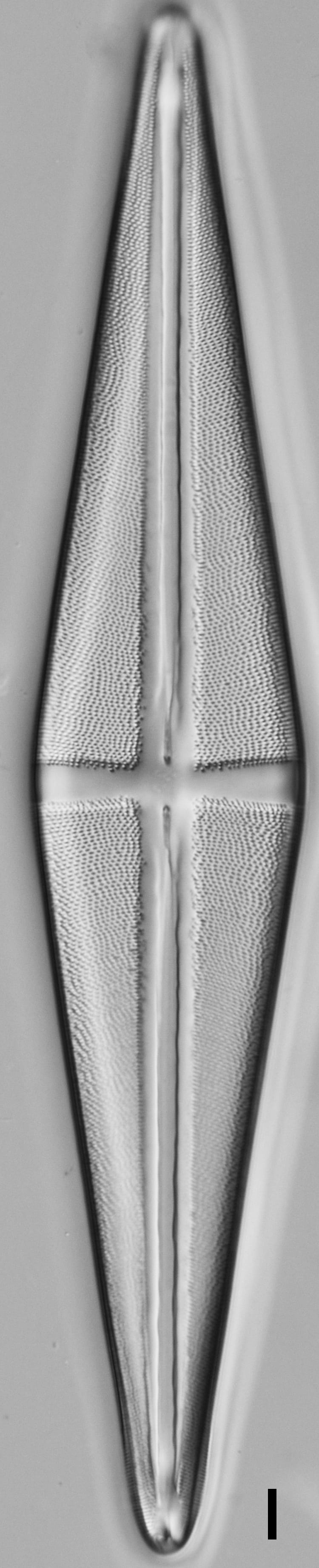 Stauroneis terryi LM2