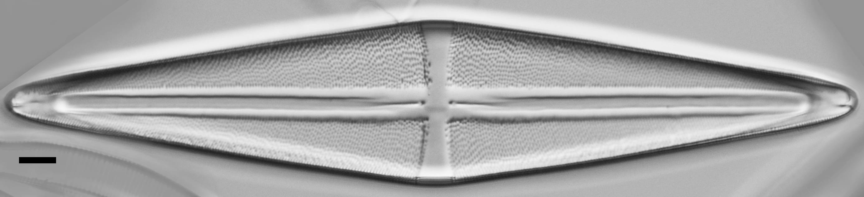 Stauroneis terryi LM4
