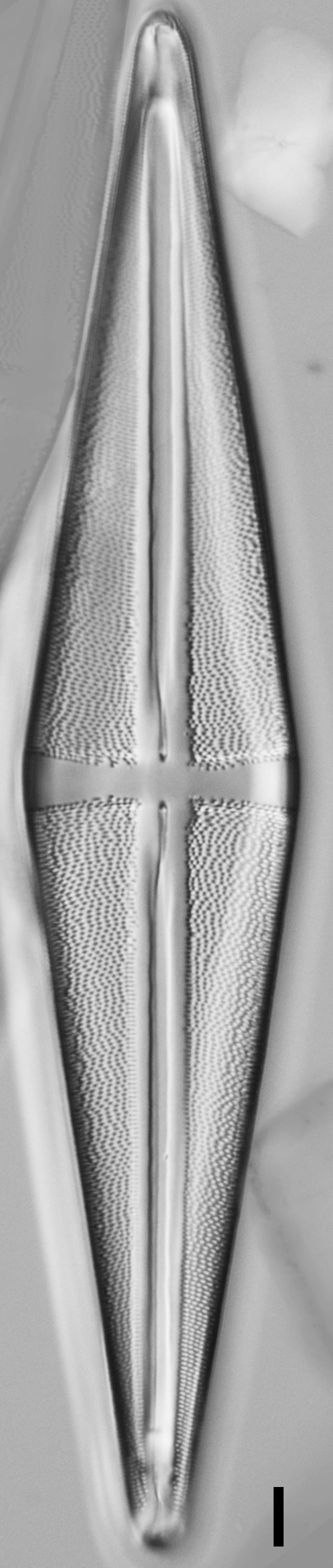 Stauroneis terryi LM5
