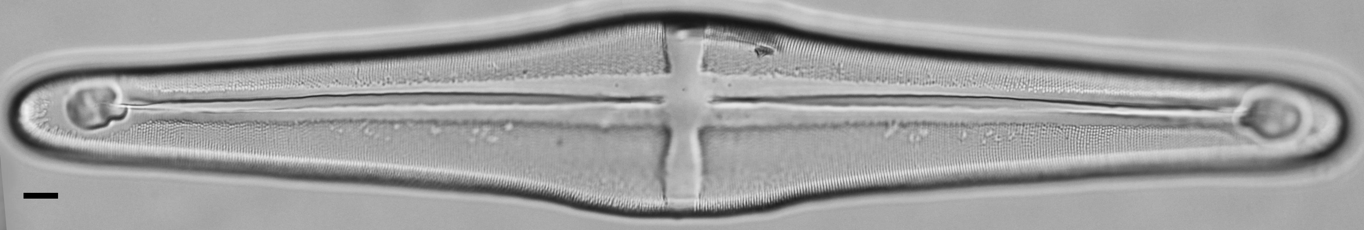 Stauroneis terryi LM6