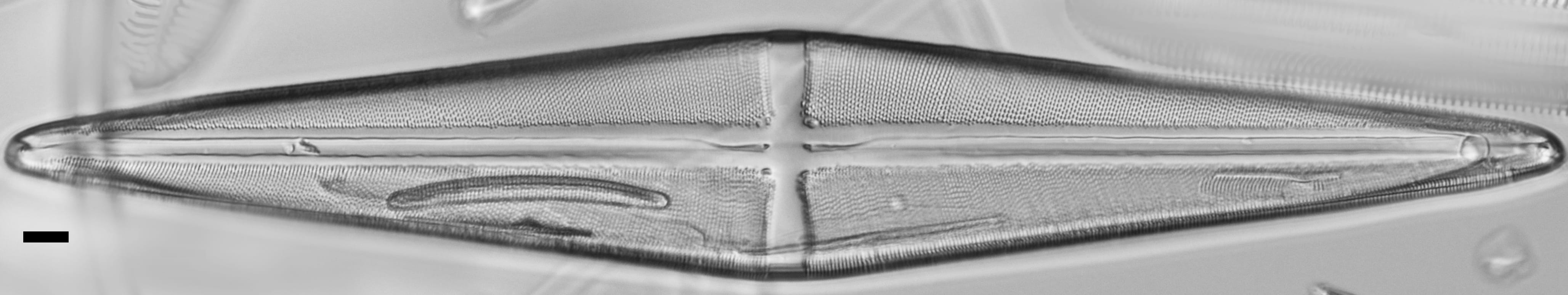 Stauroneis terryi LM7