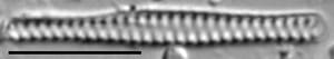 Staurosirella berolinensis LM3