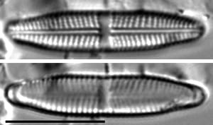 Stauroneis bovbjergii LM4