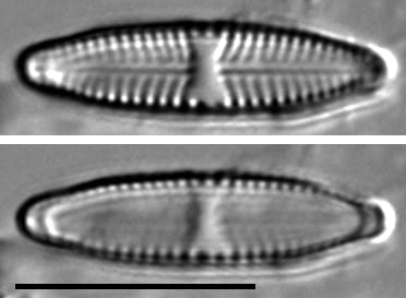 Stauroneis bovbjergii LM5