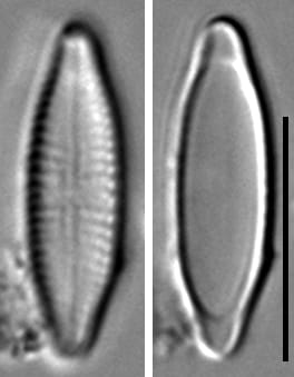Stauroneis bovbjergii LM6